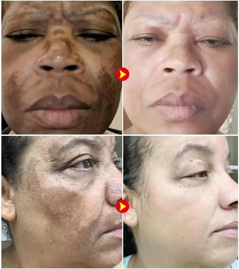 LUMIRELAX Whitening Cream - Dark Spot Corrector & Brightening Treatment