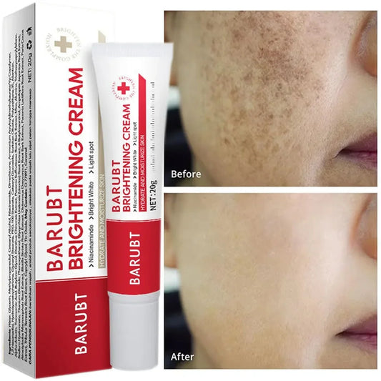 LUMIRELAX Whitening Cream - Freckle & Dark Spot Remover