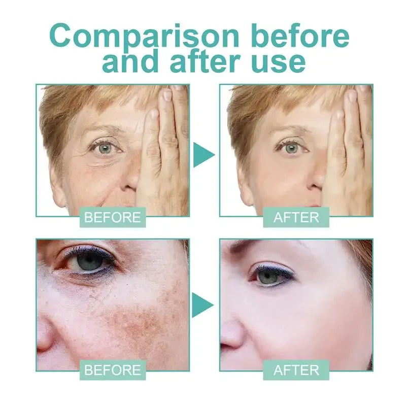 LUMIRELAX Whitening Cream - Dark Spot Corrector & Brightening Treatment