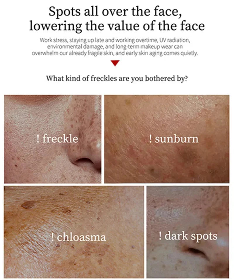 LUMIRELAX Whitening Cream - Dark Spot Corrector & Brightening Treatment